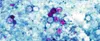 Cyclosporiasis