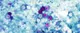 CYCLOSPORA
